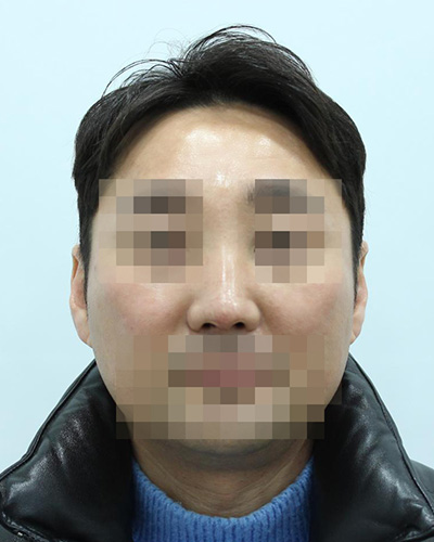 After