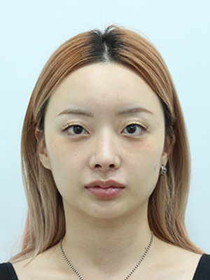After