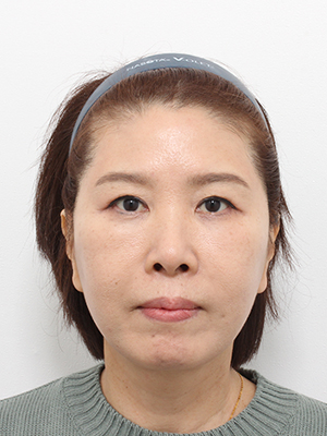 After