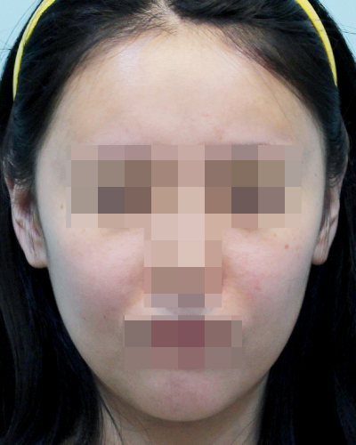 After