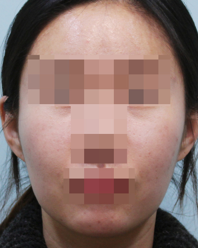 After