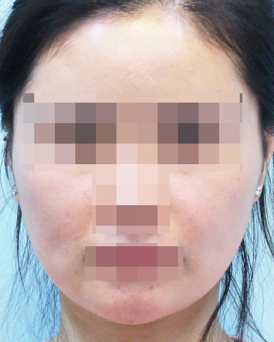 After