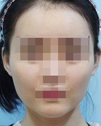 After