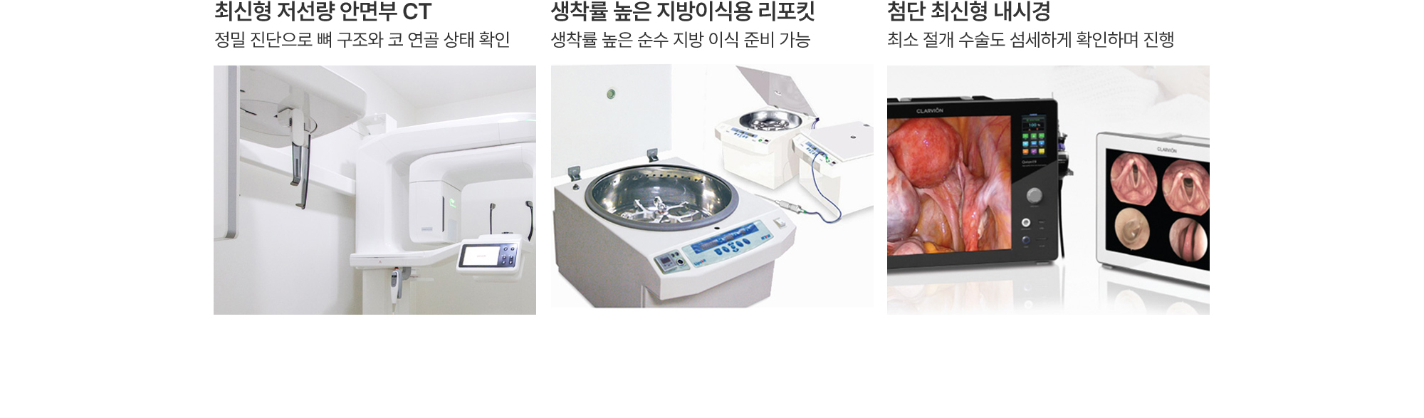 최신형 저선량 안면부 CT:정밀 진단으로 뼈 구조와 코 연골 상태 확인, 생착률 높은 지방이식용 리포킷:생착률 높은 순수 지방 이식 준비 가능, 첨단 최신형 내시경:최소 절개 수술도 섬세하게 확인하며 진행