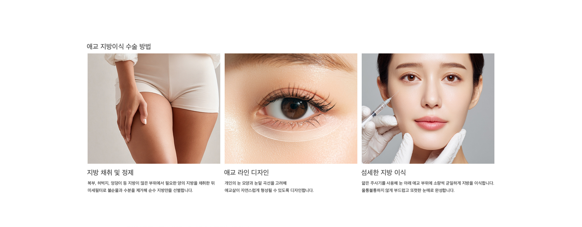 애교 지방이식 수술 방법 지방 채취 및 정제 : 복부, 허벅지, 엉덩이 등 지방이 많은 부위에서 필요한 양의 지방을 채취한 뒤 미세필터로 불순물과 수분을 제거해 순수 지방만을 선별합니다. 애교 라인 디자인 : 개인의 눈 모양과 눈밑 곡선을 고려해 애교살이 자연스럽게 형성될 수 있도록 디자인합니다. 섬세한 지방 이식 : 얇은 주사기를 사용해 눈 아래 애교 부위에 소량씩 균일하게 지방을 이식합니다. 울퉁불퉁하지 않게 부드럽고 또렷한 눈매로 완성합니다.