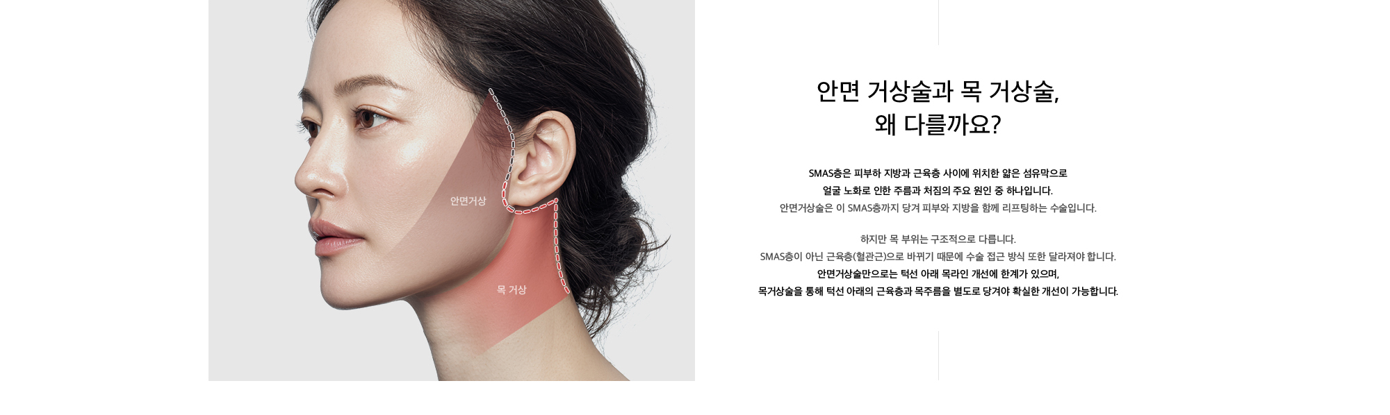 
        안면 거상술과 목 거상술, 왜 다를까요?
        SMAS층은 피부하 지방과 근육층 사이에 위치한 얇은 섬유막으로, 
        얼굴 노화로 인한 주름과 처짐의 주요 원인 중 하나입니다.
        안면거상술은 이 SMAS층까지 당겨 피부와 지방을 함께 리프팅하는 수술입니다.
        하지만 목 부위는 구조적으로 다릅니다.
        SMAS층이 아닌 근육층(혈관근)으로 바뀌기 때문에 수술 접근 방식 또한 달라져야 합니다.
        안면거상술만으로는 턱선 아래 목라인 개선에 한계가 있으며,
        목거상술을 통해 턱선 아래의 근육층과 목주름을 별도로 당겨야 확실한 개선이 가능합니다.
        