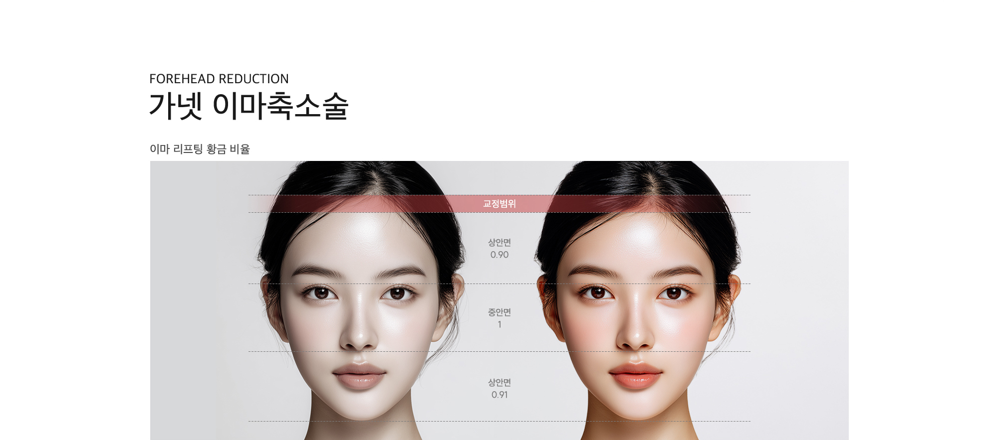 
        Forehead Reduction
        가넷 이마축소술
        이마 리프팅 황금 비율