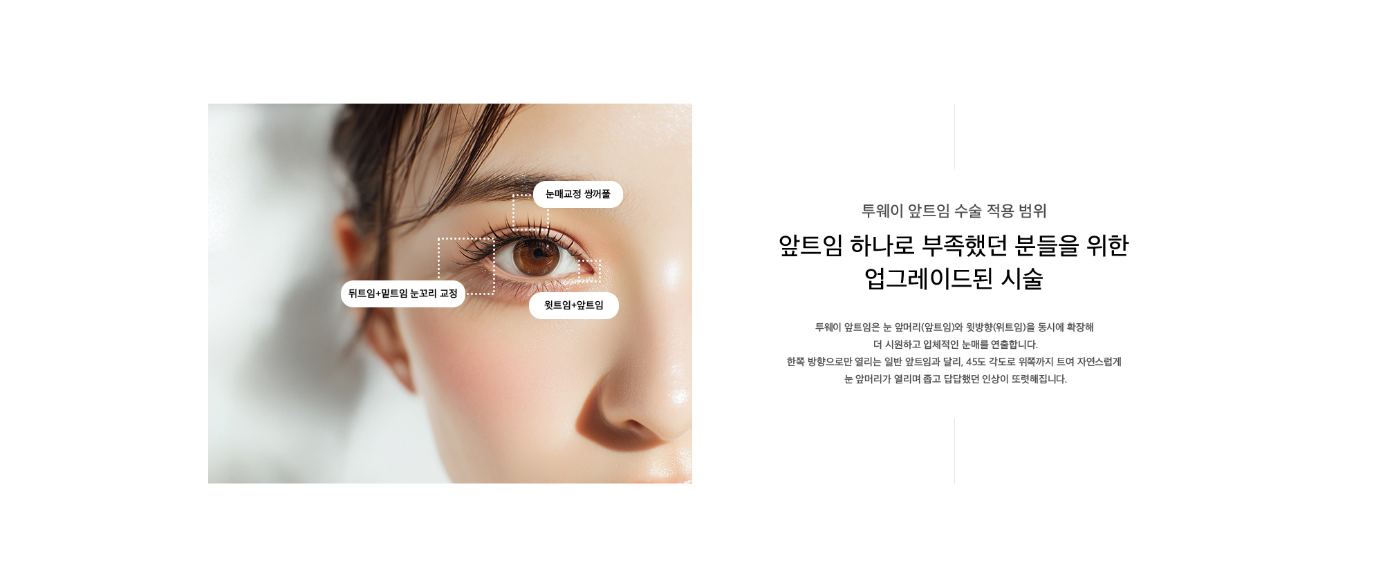 투웨이 앞트임 수술 적용 범위 앞트임 하나로 부족했던 분들을 위한 업그레이드된 시술 투웨이 앞트임은 눈 앞머리(앞트임)와 윗방향(위트임)을 동시에 확장해  더 시원하고 입체적인 눈매를 연출합니다. 한쪽 방향으로만 열리는 일반 앞트임과 달리, 45도 각도로 위쪽까지 트여 자연스럽게  눈 앞머리가 열리며 좁고 답답했던 인상이 또렷해집니다.