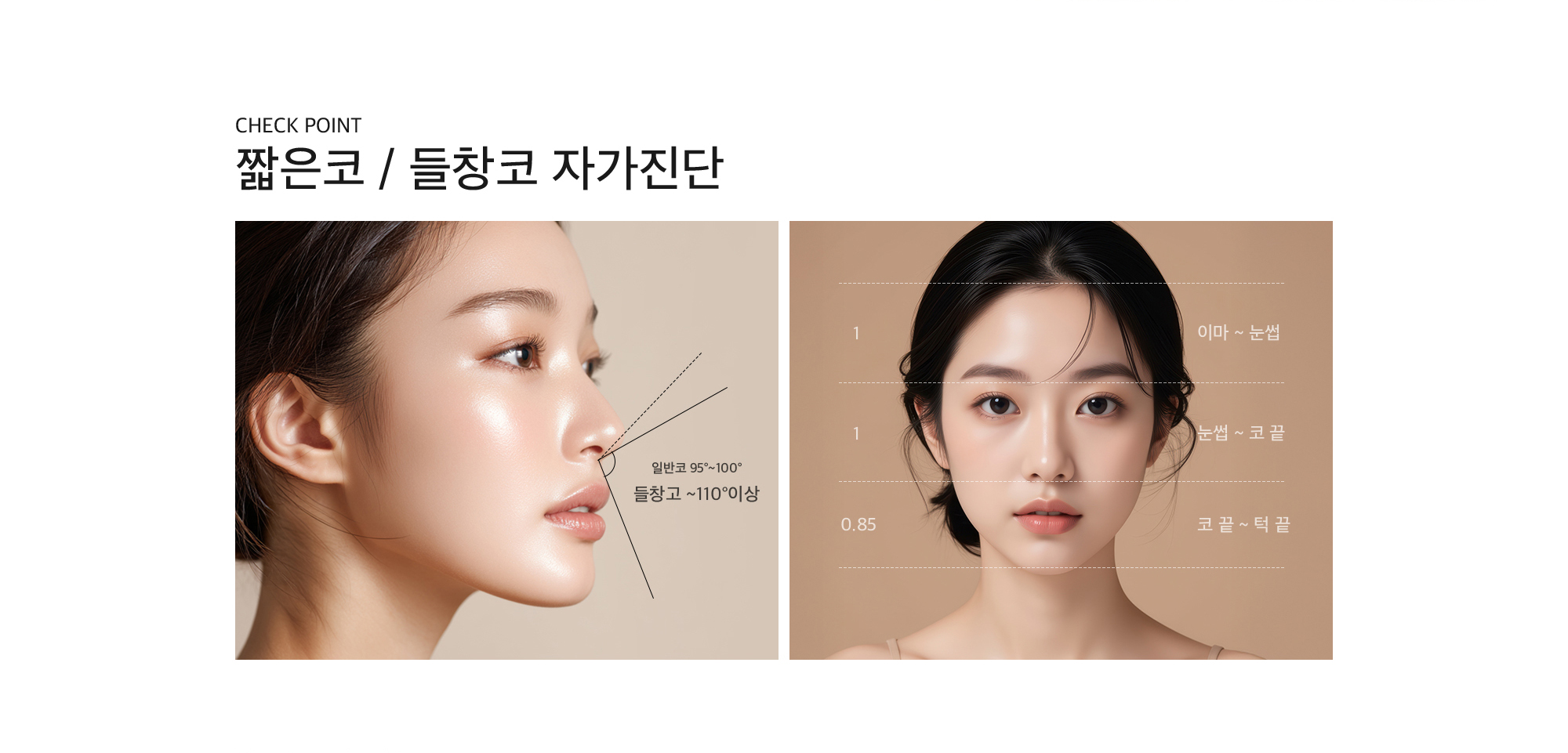 Check Point 짧은코 / 들창코 자가진단 일반코 : 95°~100° 들창고 : ~110°이상